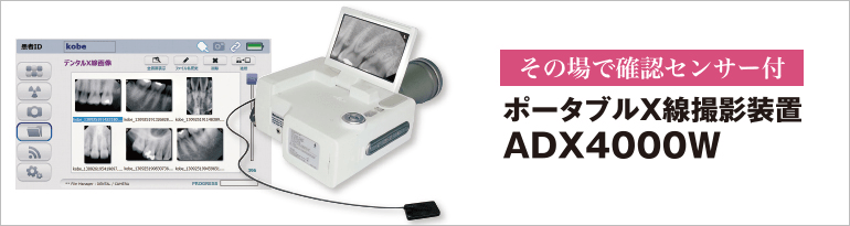 その場で確認センサー付き ポータブルX線撮影装置 ADX4000W